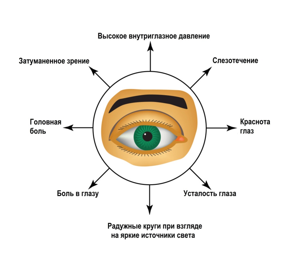 глаукома.jpg глаукома.jpg